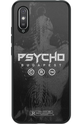 X-Ray - Xiaomi Redmi 9A