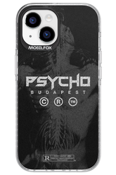 X-Ray - Apple iPhone 15