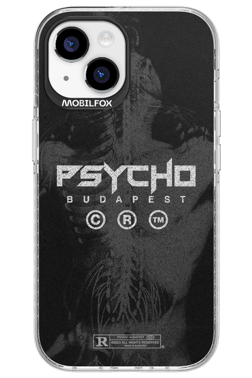 X-Ray - Apple iPhone 15