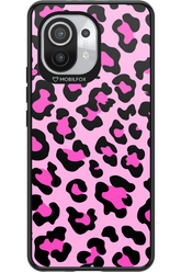 PINK LEOPARD 2.0 - Xiaomi Mi 11 5G