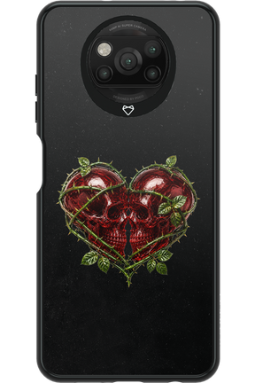 Omen Kiss 2.0 - Xiaomi Poco X3 NFC
