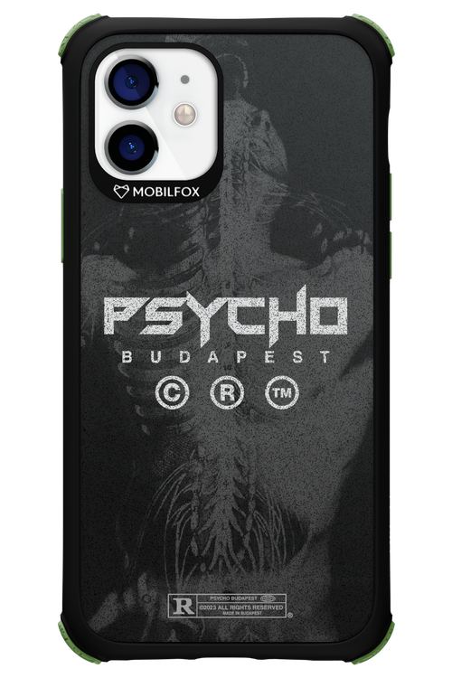 X-Ray - Apple iPhone 12