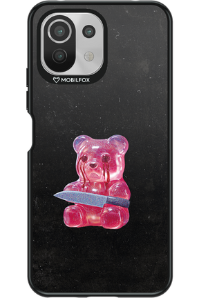 Yummy - Xiaomi Mi 11 Lite (2021)