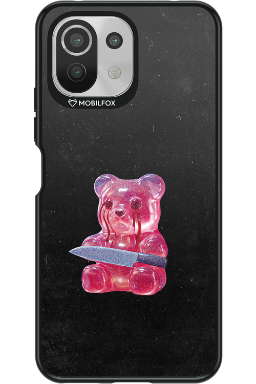 Yummy - Xiaomi Mi 11 Lite (2021)