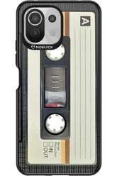 CASE 11 2.0 - Xiaomi Mi 11 Lite (2021)