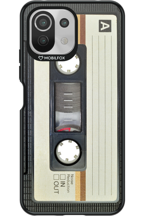 CASE 11 2.0 - Xiaomi Mi 11 Lite (2021)