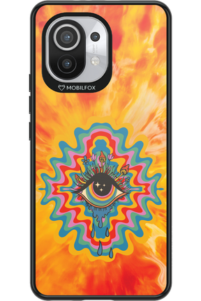 ThirdEye 2.0 - Xiaomi Mi 11 5G