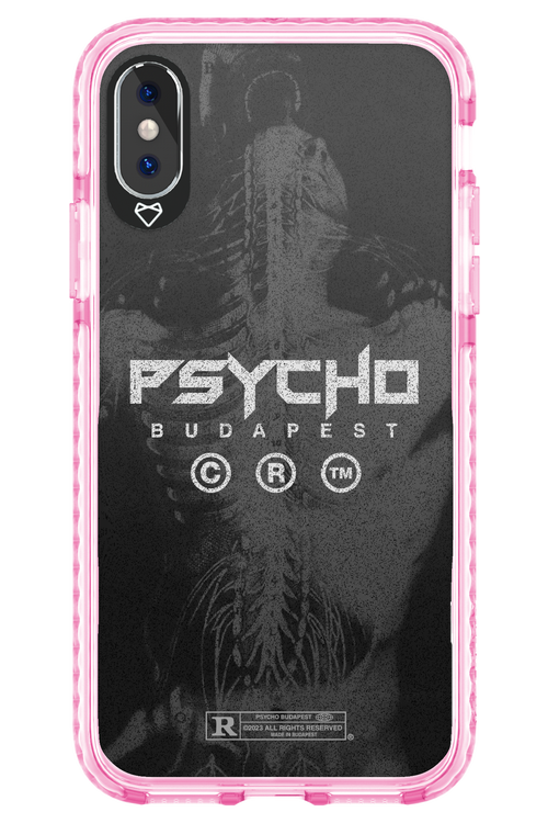 X-Ray - Apple iPhone XS