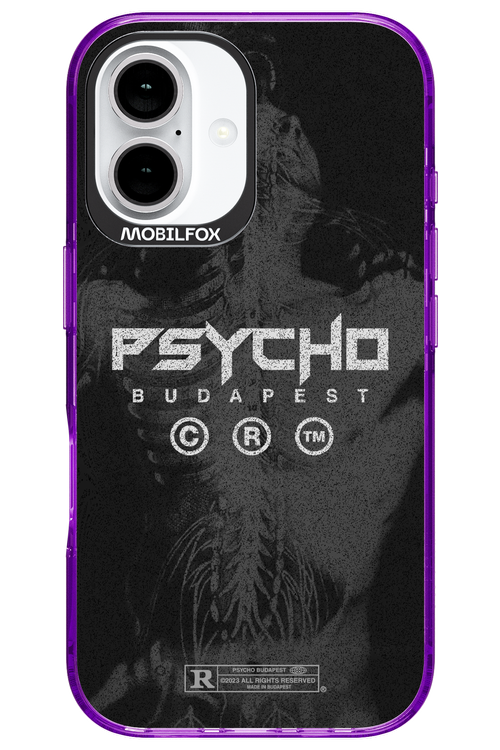 X-Ray - Apple iPhone 16