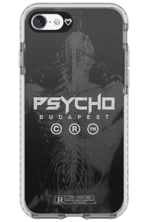 X-Ray - Apple iPhone 7