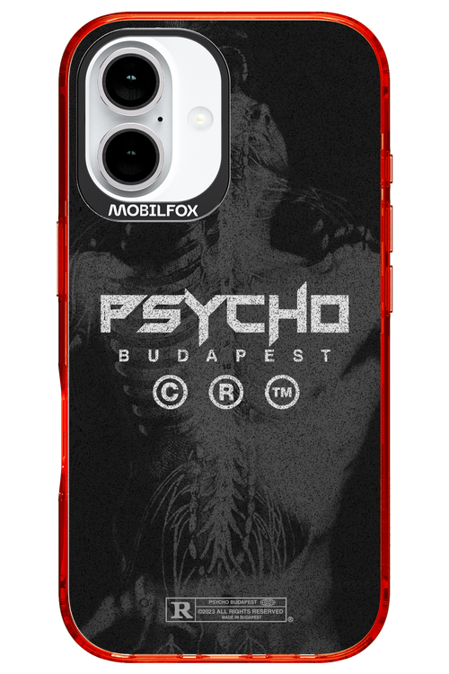 X-Ray - Apple iPhone 16