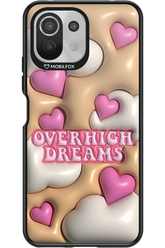 Overhigh Dreams - Xiaomi Mi 11 Lite (2021)