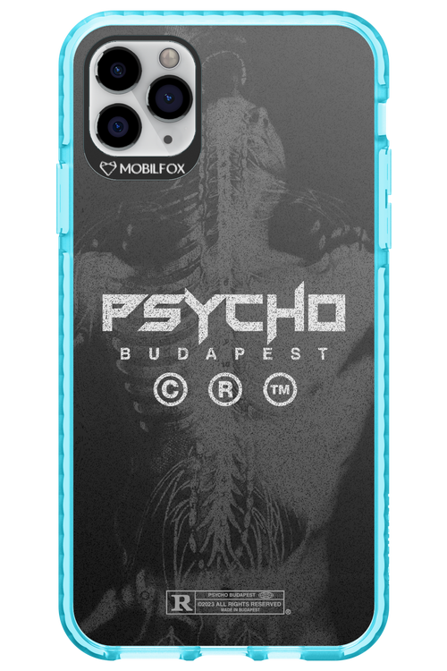 X-Ray - Apple iPhone 11 Pro Max