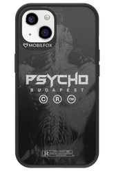 X-Ray - Apple iPhone 13