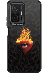 Shit happens - Xiaomi Mi 11T