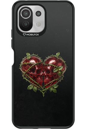 Omen Kiss 2.0 - Xiaomi Mi 11 Lite (2021)
