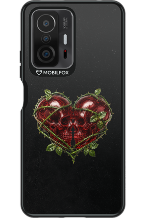 Omen Kiss 2.0 - Xiaomi Mi 11T
