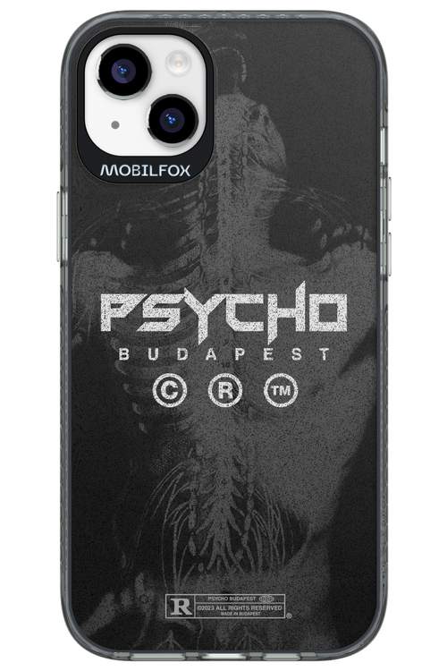X-Ray - Apple iPhone 14 Plus