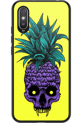 Pineapple Skull - Xiaomi Redmi 9A