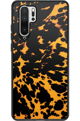 Tortoise Shell 2.0 - Huawei P30 Pro