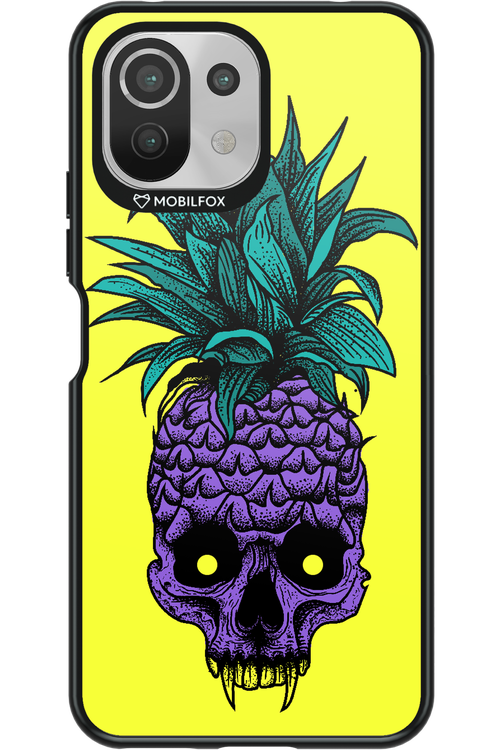 Pineapple Skull - Xiaomi Mi 11 Lite (2021)