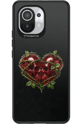 Omen Kiss 2.0 - Xiaomi Mi 11 5G