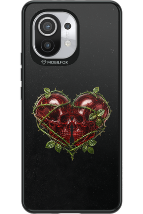 Omen Kiss 2.0 - Xiaomi Mi 11 5G