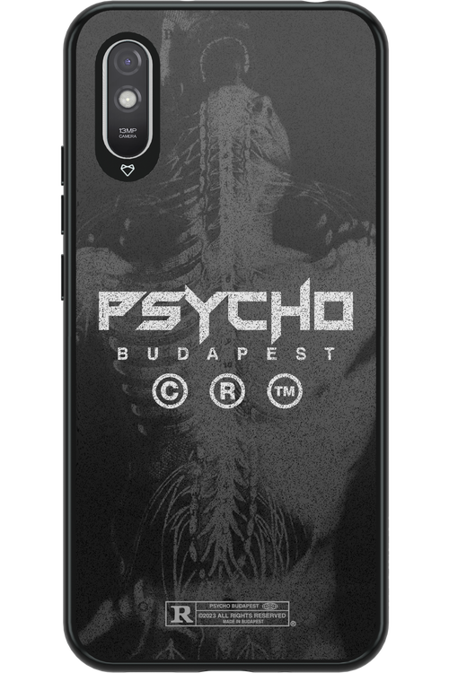 X-Ray - Xiaomi Redmi 9A