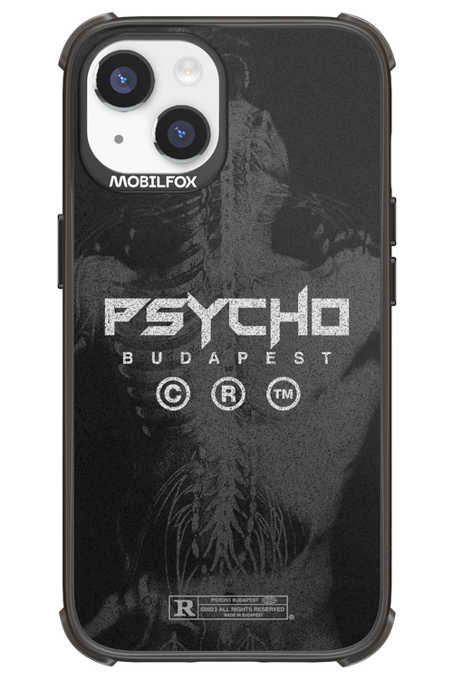 X-Ray - Apple iPhone 14