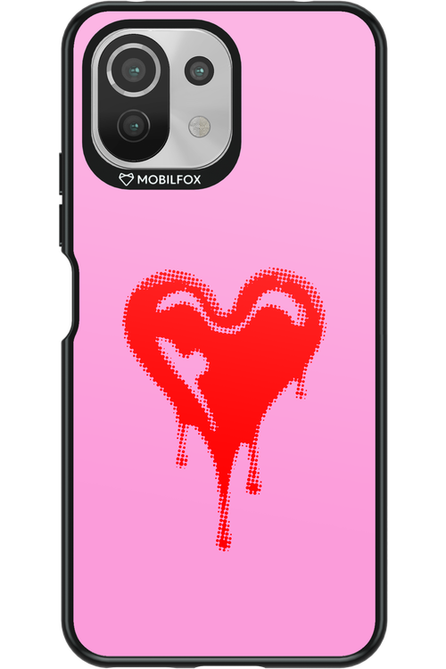 Heart Pink - Xiaomi Mi 11 Lite (2021)