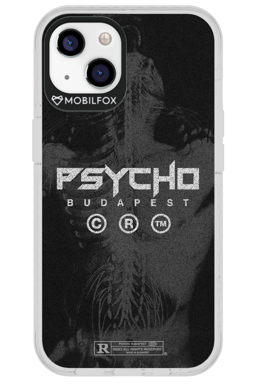 X-Ray - Apple iPhone 13