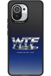 W T F 2.0 - Xiaomi Mi 11 5G
