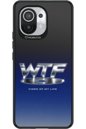 W T F 2.0 - Xiaomi Mi 11 5G