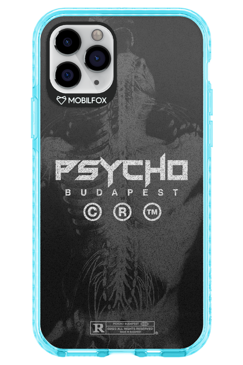 X-Ray - Apple iPhone 11 Pro
