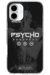 X-Ray - Apple iPhone 16 Plus