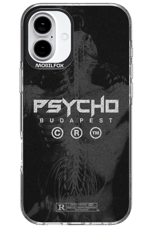 X-Ray - Apple iPhone 16 Plus