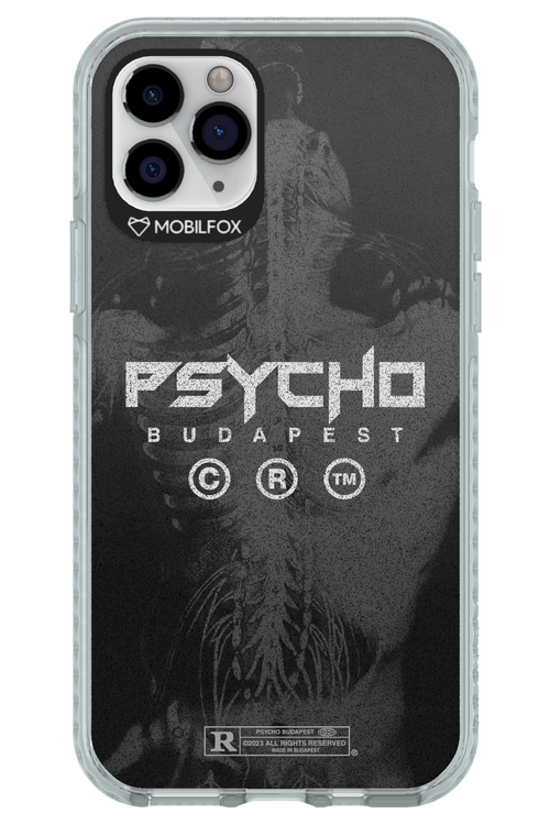 X-Ray - Apple iPhone 11 Pro