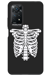SKELETON - Xiaomi Redmi Note 11Pro 4G/5G