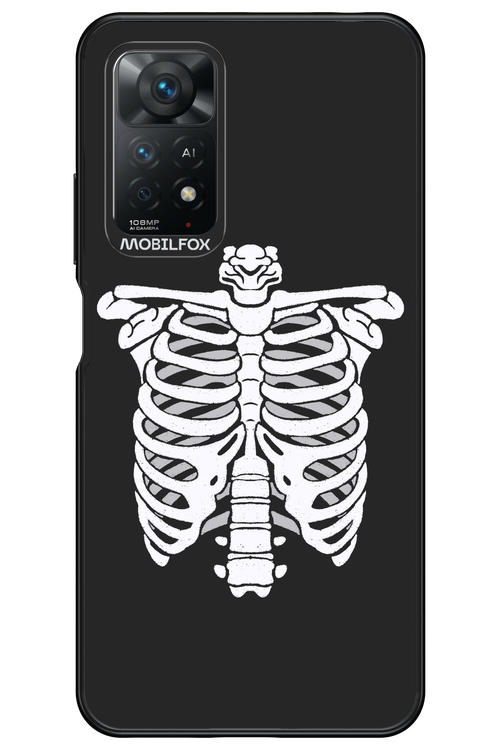 SKELETON - Xiaomi Redmi Note 11Pro 4G/5G