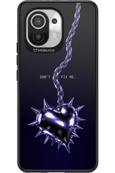 Don't fix me 2.0 - Xiaomi Mi 11 5G