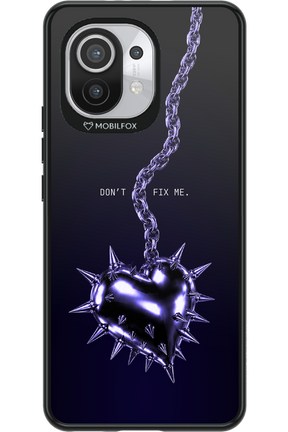 Don't fix me 2.0 - Xiaomi Mi 11 5G