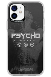 X-Ray - Apple iPhone 12