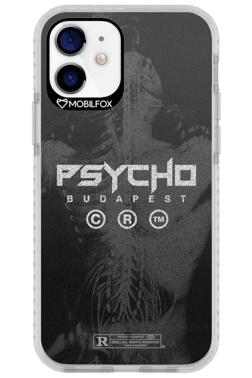 X-Ray - Apple iPhone 12