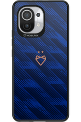 Franta 2.0 x Mobilfox 2.0 - Xiaomi Mi 11 5G