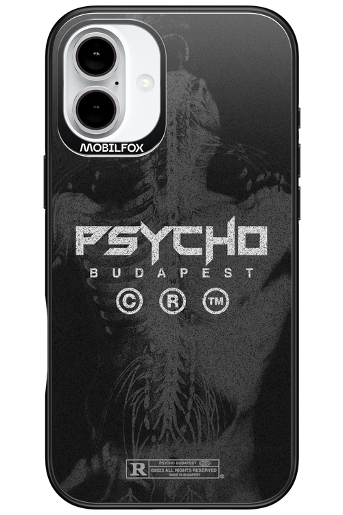 X-Ray - Apple iPhone 16 Plus