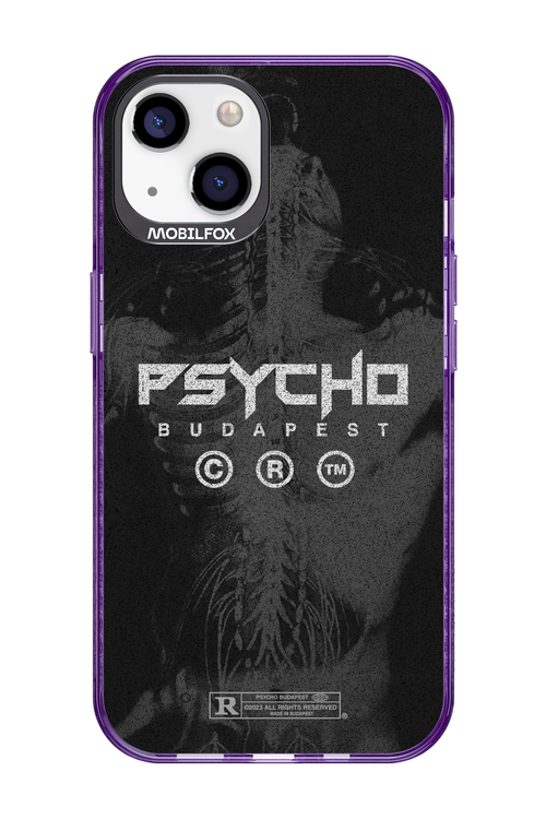 X-Ray - Apple iPhone 13