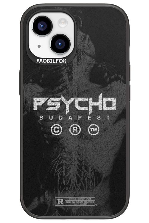 X-Ray - Apple iPhone 15