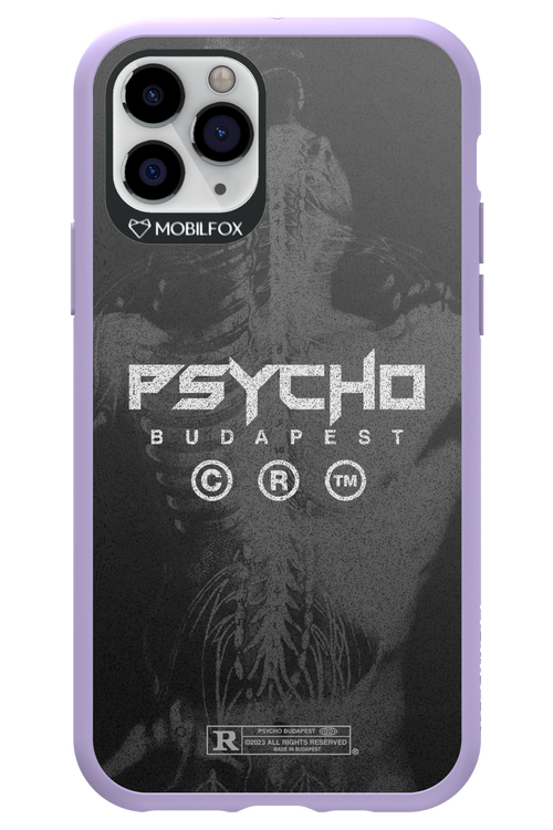 X-Ray - Apple iPhone 11 Pro