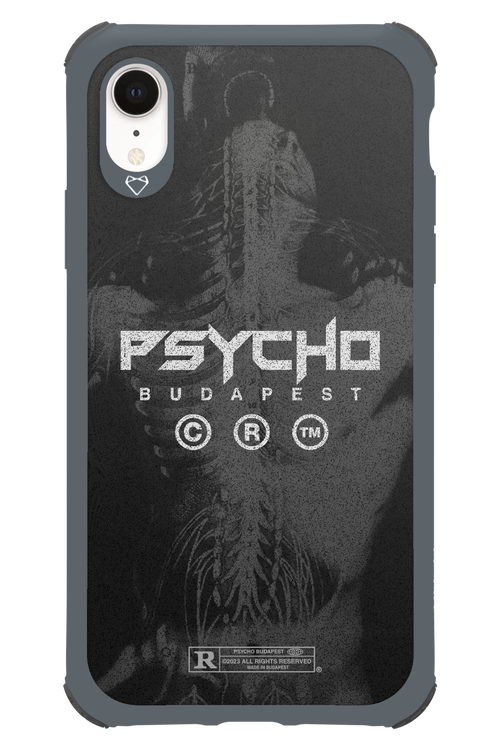 X-Ray - Apple iPhone XR