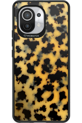 Tortoiseshell 2.0 - Xiaomi Mi 11 5G